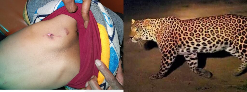 Leopard Attack in Chopal: 5-Year-Old Girl Injured, Fear Grips Villagers