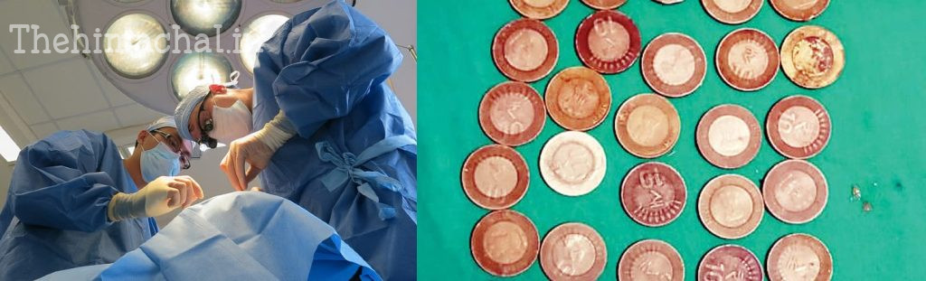 man-stomach-33-coins-removed-rainbow-hospital-doctors-saved-life